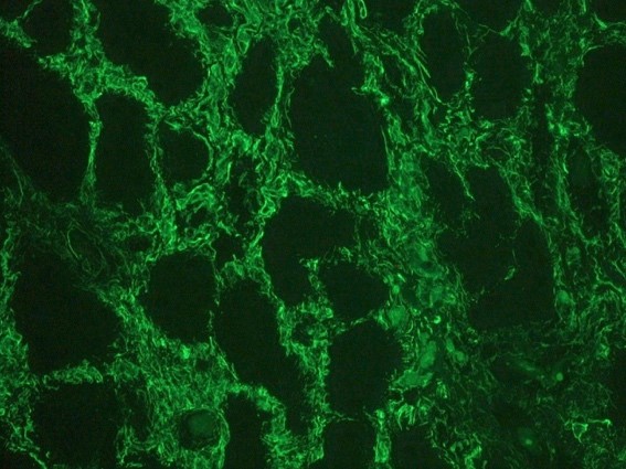 Figure 3. Indirect immunofluorescence staining of human kidney tissue section with MUB1904P (diluted 1:1000), showing the specific pattern of vimentin in the mesenchymal cell types, such as fibroblasts in the connective tissue, podocytes, and endothelial cells in blood vessels. As expected, no reactivity is seen in the epithelial cell compartment.